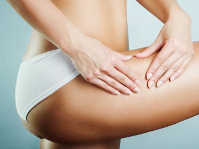 Cellulite2
